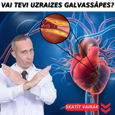 creative ArbitrageUp