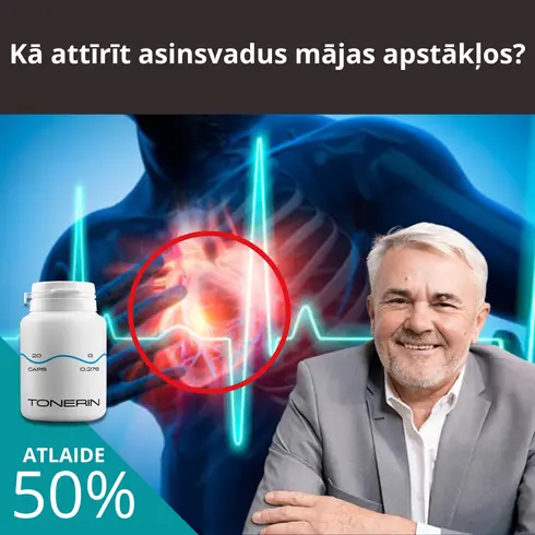 creative ArbitrageUp